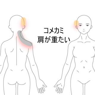 コメカミ痛