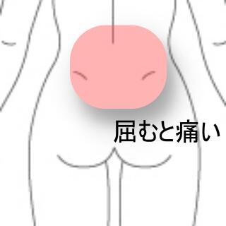 腰痛