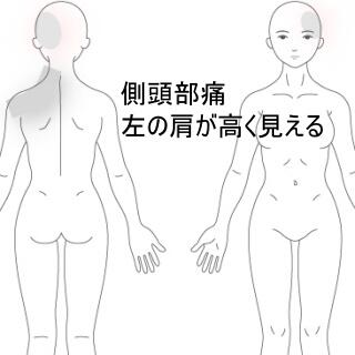頭痛