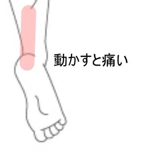 ふくらはぎの痛み