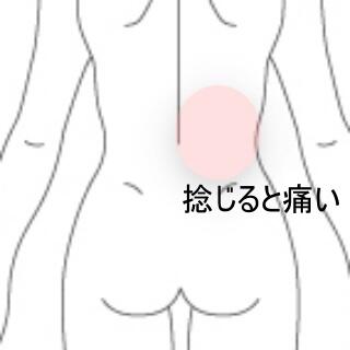 腰痛
