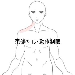 頸部のコリ