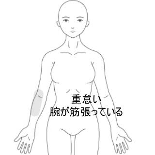 腕の痛み