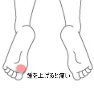 足裏の痛み