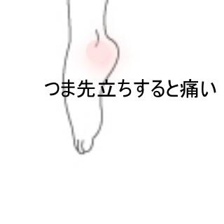 足首の痛み