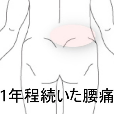 腰の痛み