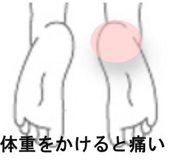 踵の痛み