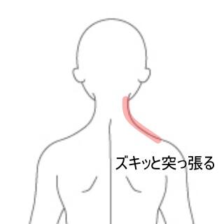 首の痛み