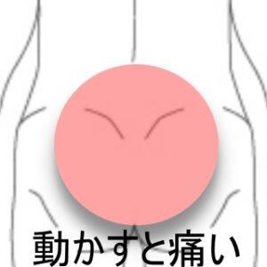 腰痛