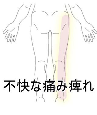 脚の痺れ・痛み