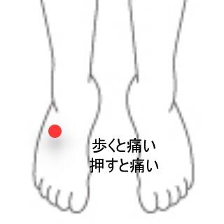 がいけいこつ