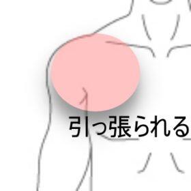 肩の痛み 野球少年