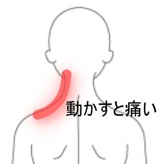 首痛み