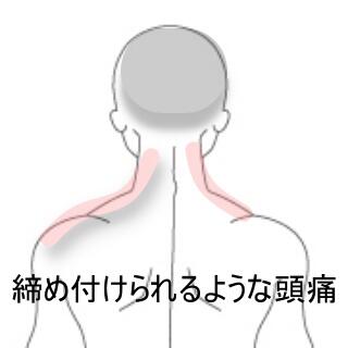 頭痛