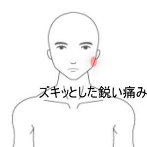 顎の痛み