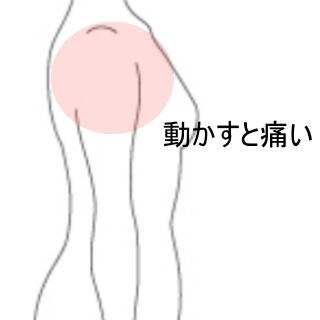肩の痛み