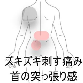 腰痛　首の痛み