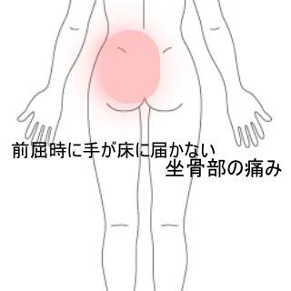 前屈時の痛み