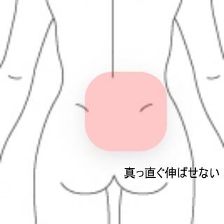 腰痛