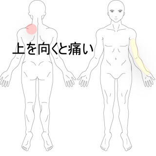 頸部の痛み