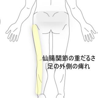 足の痺れ