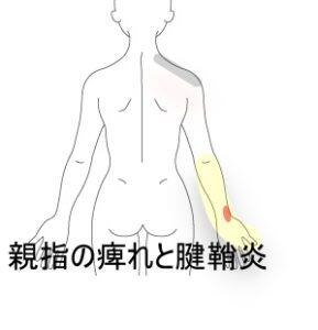 腕全体の痺れ