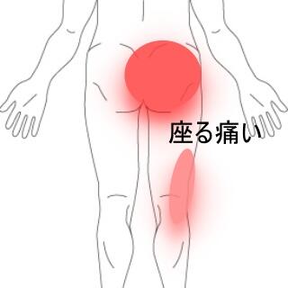 腰部下肢痛
