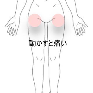 股関節前側の痛み