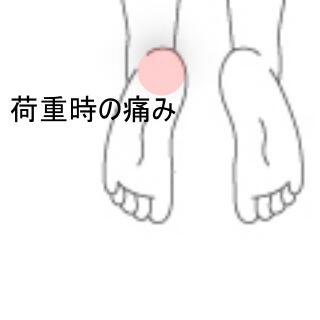 踵の痛み