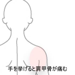 肩甲骨の痛み