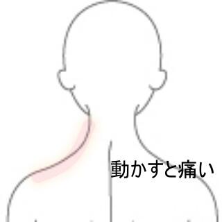 頸部痛