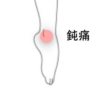足首の痛み