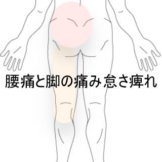 腰臀部痛
