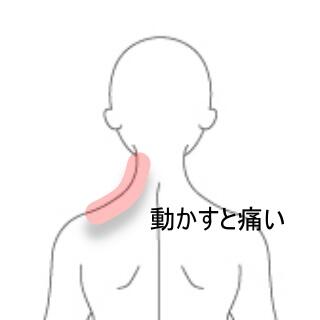 首痛み