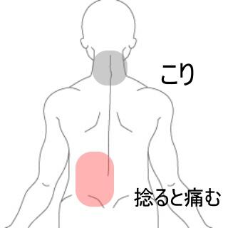 腰痛