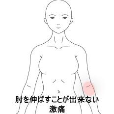 肘の痛み　