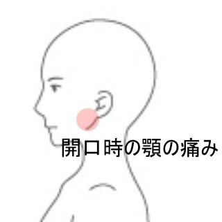 顎関節症