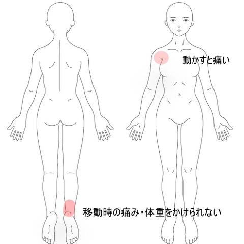アキレス腱の痛み