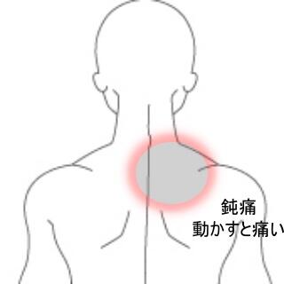 背中の痛み