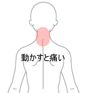 頸の痛み