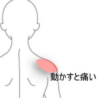 肩痛