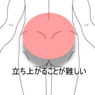 ギックリ腰