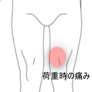 膝の痛み