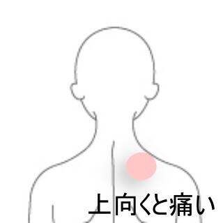 頸部痛