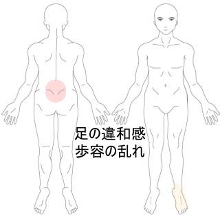 大腿部痛