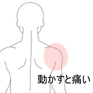 肩の痛み