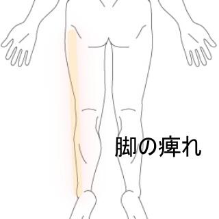 下肢痺れ