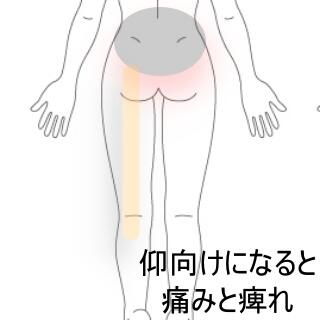 腰椎椎間板ヘルニア