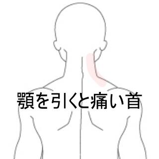 首の痛み