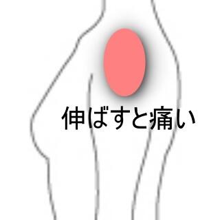 肩の痛み